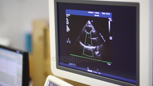Video Beeld Monitor Tijdens Een Echografie Van Patiënt — Stockvideo