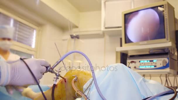 Handen Van Arts Display Tijdens Endoscopie Chirurgie Kniegewricht — Stockvideo