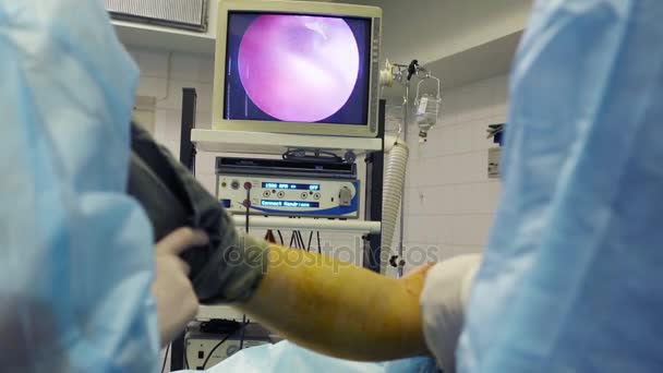 Orvos Lábak Beteg Bemutatás Során Endoszkópos Műtét Térd Ízületi Kéz — Stock videók