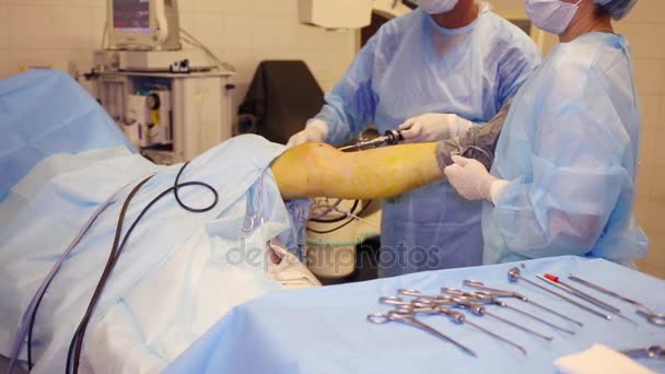 Médico Enfermeiro Mãos Durante Cirurgia Endoscópica Joelho Clínica — Vídeo de Stock