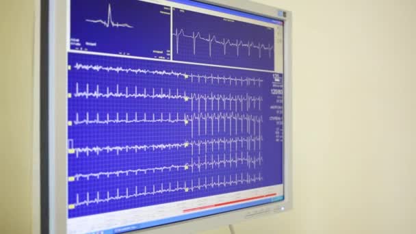 Monitor Pokazuje Pewien Kardiogram Czasie Rzeczywistym Podczas Badania Stresu — Wideo stockowe