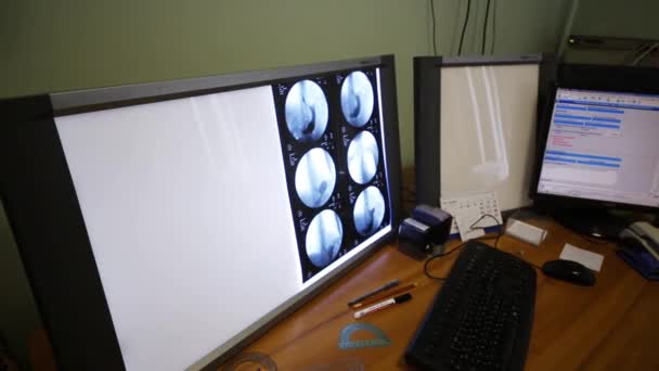 Displays Mit Röntgenaufnahmen Auf Einem Tisch Büro Des Arztes — Stockvideo
