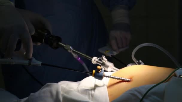 Mãos Nas Luvas Realizam Cirurgia Endoscópica Órgão Abdominal — Vídeo de Stock