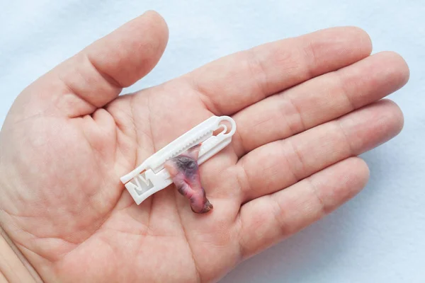 Umbilical cord on hand — Stock Photo, Image