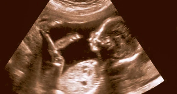 Análise ultrassonográfica de um feto de quarto mês — Fotografia de Stock