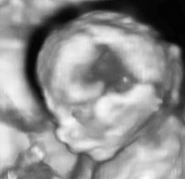 4 ayda cenin 3D Ultrasonografi analizleri — Stok fotoğraf