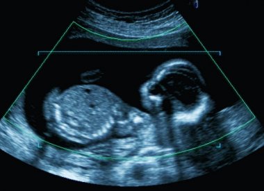 Medical image of mother's womb ultrasound during pregnancy. clipart