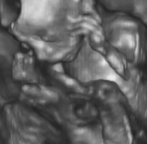意大利实验室4个月胎儿的三维超声分析 — 图库照片
