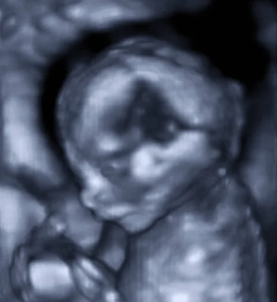 Ultraschall Bild Des Babys Mutterleib — Stockfoto