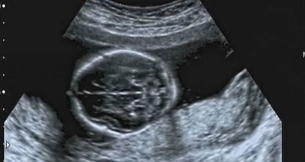 8 375 Baby Scan Stock Photos Baby Scan Images Depositphotos