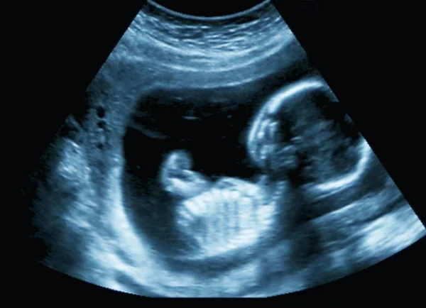 Ultrazvuk Lidského Plodu Týdnu — Stock fotografie