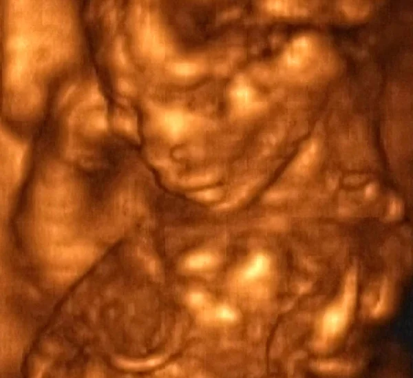 4. Ay Fetüsü 'nün 3D Ultrasonografi Analizi, İtalyan Laboratuvarları