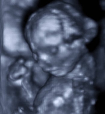 An ultrasound of a human fetus during the 16th week. clipart