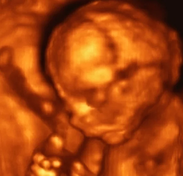 Ultraschalluntersuchung Eines Fetus Monat Italien — Stockfoto