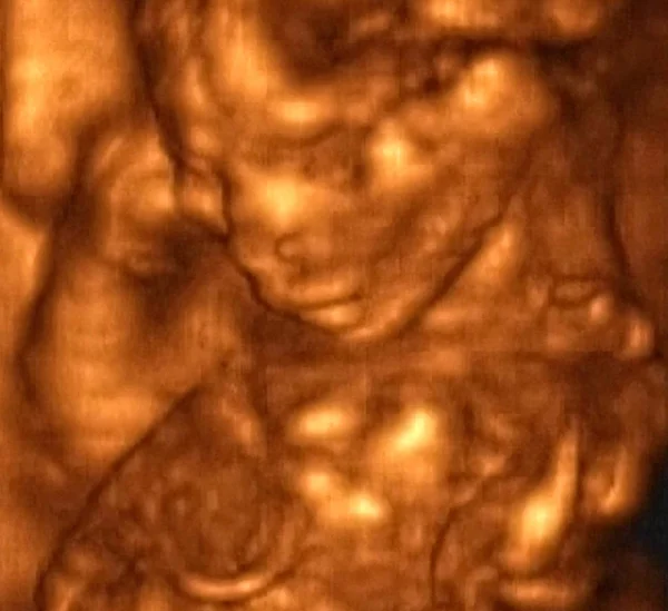 4ヶ月の胎児の3D超音波検査 イタリアの研究所 — ストック写真