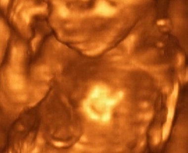 4. Ay Fetüsü 'nün 3D Ultrasonografi Analizi, İtalyan Laboratuvarları