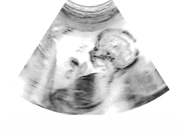 Ultralyd Baby Mors Livmoder - Stock-foto
