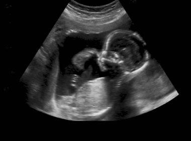 Ultrasound of baby in mother's womb. clipart