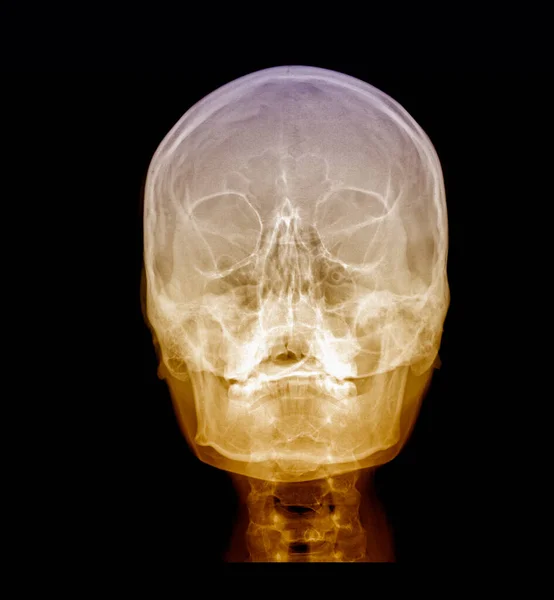 Visão frontal da varredura médica de raios X do cérebro humano — Fotografia de Stock