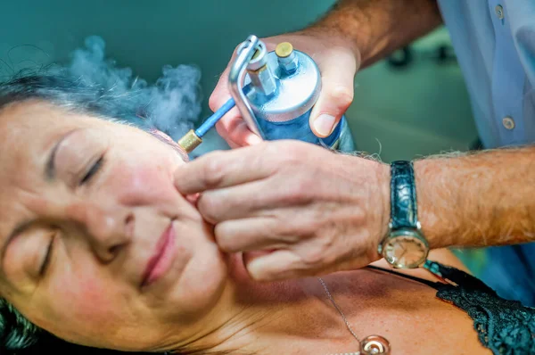 Close Van Vrouw Die Een Lokale Cryotherapie Behandeling Haar Gezicht — Stockfoto