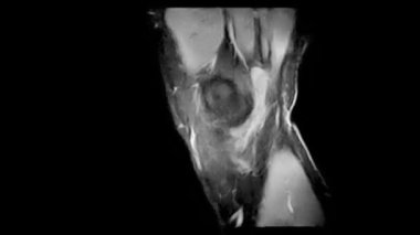 Bir adamın MRI taramasının animasyon görüntüleri