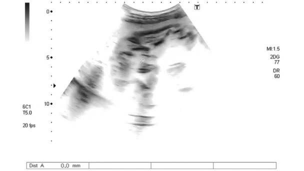 黑白照片 第四个月的片段 — 图库视频影像