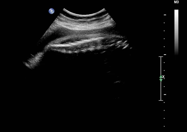 Ultrasuoni del feto durante la gravidanza del terzo mese — Foto Stock