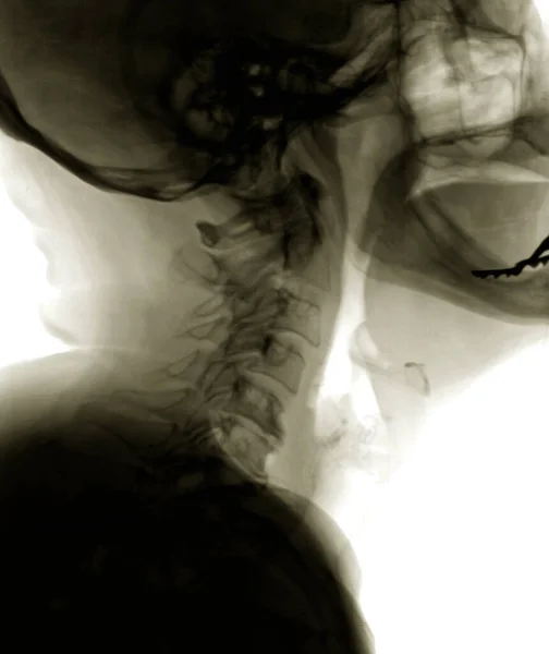 Diagnóstico Radiografia Cabeça Paciente Visão Lateral — Fotografia de Stock
