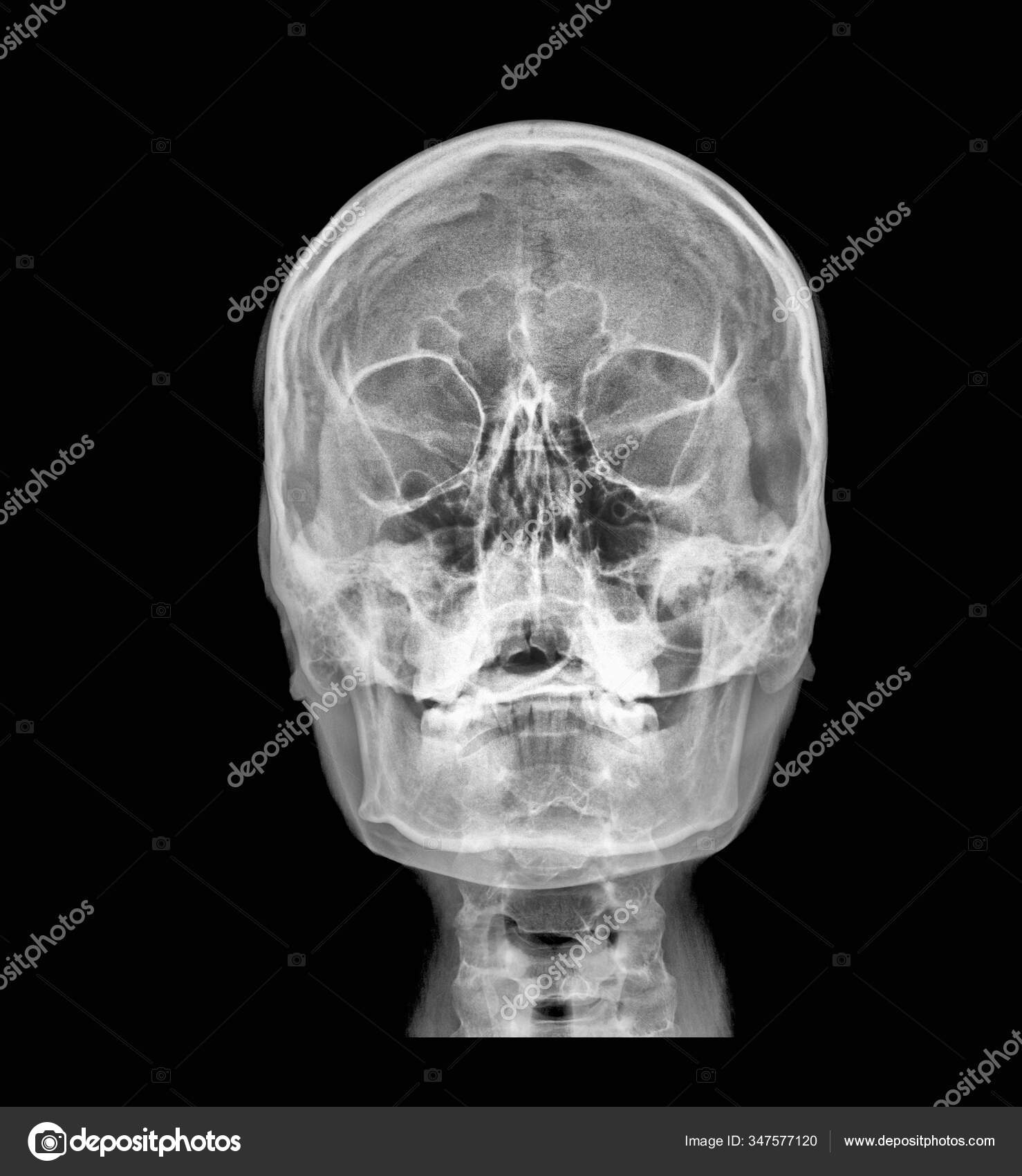 Front View Human Brain Ray Medical Scan Stock Photo by ©jovannig 347577120