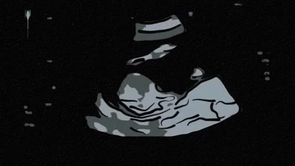 Стилізоване Зображення Ультразвукового Обстеження Вагітної Жінки Ембріоном Яскравими Лініями Ехо — стокове відео