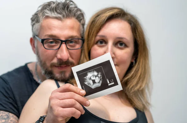 Mère Enceinte Avec Son Mari Montrant Échographie Fœtus — Photo