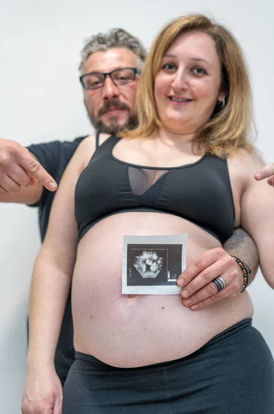 Terhes Anya Férjével Mutatja Magzat Ultrahang — Stock Fotó