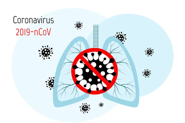 Vírussejtek a tüdőben. Fertőzött tüdő. Coronavirus, COVID-19. 2019-nCoV. tüdőbetegség, tüdőgyulladás, asztma, rák, tuberkulózis. — Stock Vector