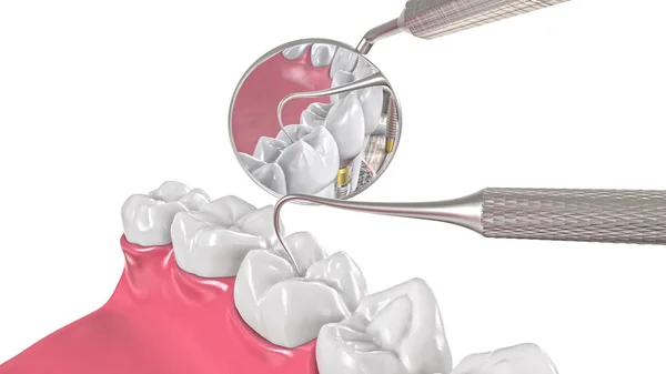 Dentes de mandíbula e espelho dentista ilustração 3d — Fotografia de Stock