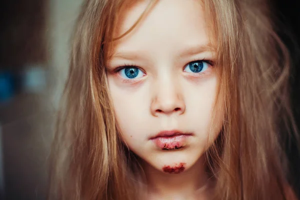 Söt liten flicka med blod sår på hennes ansikte. — Stockfoto
