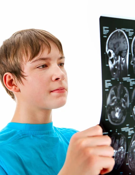 Adolescente con rayos X — Foto de Stock