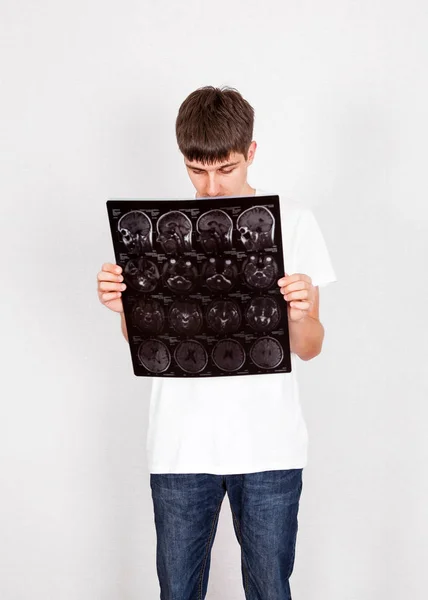 Mladý muž s tomografie — Stock fotografie