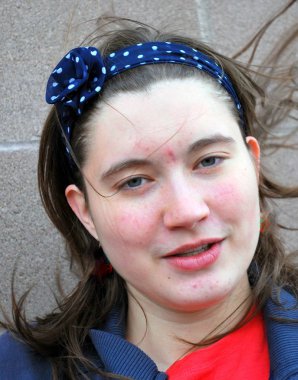 Açık havada akne ifadeleri ile kadın genç güzellik.