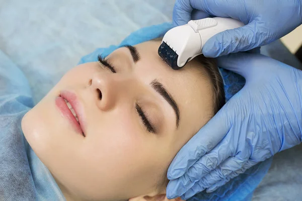 Mesotherapy face by mezoroller. — Stock Photo, Image