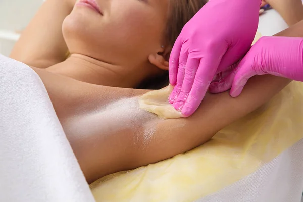 Sugaring: epilation with liquate sugar at armpit. — Stock Photo, Image