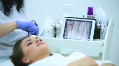 Hastalığı saç ve cilt bir trichoscope kullanarak bir çalışma.