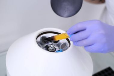 Kan centrifuging araştırmacı gerçekleştirir