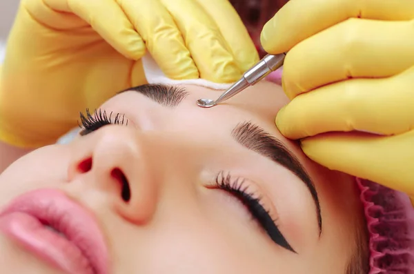 Limpieza profesional del acné en un salón de belleza . — Foto de Stock