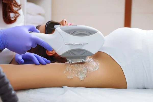 Tendo underarm depilação depilação a laser — Fotografia de Stock