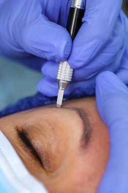 Microblasting eski makyaj kaldırmak.