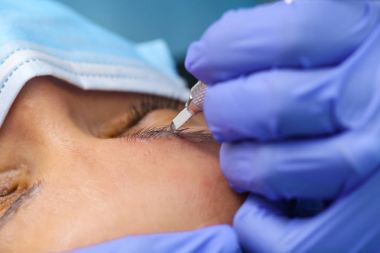 Microblasting eski makyaj kaldırmak.