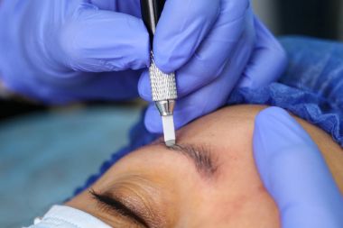 Microblasting eski makyaj kaldırmak.