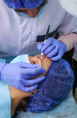 Microblasting eski makyaj kaldırmak.