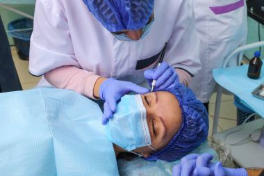 Microblasting eski makyaj kaldırmak.