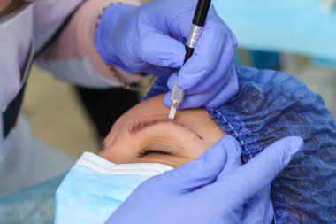 Microblasting eski makyaj kaldırmak.